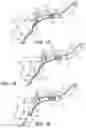 Fig. 16 - Catheter systems and methods for medical procedures using catheters
