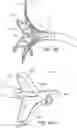 Fig. 27 - Catheter systems and methods for medical procedures using catheters
