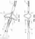 Fig. 41 - Catheter systems and methods for medical procedures using catheters
