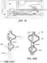 Fig. 55 - Catheter systems and methods for medical procedures using catheters