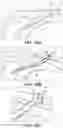 Fig. 64 - Catheter systems and methods for medical procedures using catheters