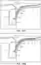 Fig. 67 - Catheter systems and methods for medical procedures using catheters