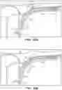 Fig. 71 - Catheter systems and methods for medical procedures using catheters