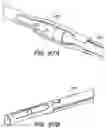 Fig. 92 - Catheter systems and methods for medical procedures using catheters