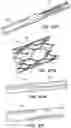 Fig. 94 - Catheter systems and methods for medical procedures using catheters