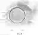 Fig. 09 - Vascular access device and method