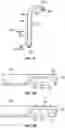 Fig. 17 - SYSTEMS, DEVICES, AND METHODS FOR HIS BUNDLE CARDIAC PACING