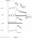 Fig. 12 - Peripheral neuromodulation to treat bladder and bowel dysfunction