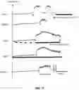Fig. 14 - Peripheral neuromodulation to treat bladder and bowel dysfunction