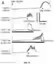 Fig. 25 - Peripheral neuromodulation to treat bladder and bowel dysfunction
