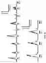 Fig. 32 - Peripheral neuromodulation to treat bladder and bowel dysfunction