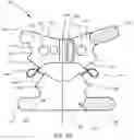 Fig. 07 - System, method, and apparatus for applying transcutaneous electrical stimulation