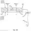 Fig. 09 - Implantable battery device for standard cochlear implant