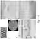 Fig. 06 - HIGH DENSITY RETINAL PROSTHESIS SYSTEM WITH EQUALIZATION