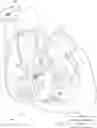 Fig. 01 - ADAPTIVE VFA CARDIAC THERAPY