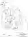 Fig. 04 - ADAPTIVE VFA CARDIAC THERAPY