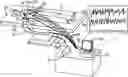 Fig. 01 - Adapter to allow electrogram visualization and pacing from temporary epicardial wires