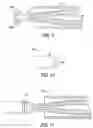 Fig. 04 - Implantable medical device with proximal capture feature