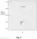 Fig. 06 - Method and device for the improvement of physical fitness