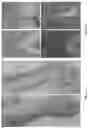 Fig. 02 - Compositions and methods for treating vitiligo