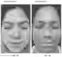 Fig. 07 - Compositions and methods for treating vitiligo
