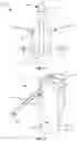 Fig. 04 - Portable fire extinguisher adapted for persons with disabilities