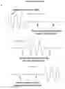 Fig. 13 - DEVICES AND METHODS FOR EXERCISE OR ANALYSIS OF THE NECK REGION
