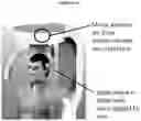 Fig. 17 - DEVICES AND METHODS FOR EXERCISE OR ANALYSIS OF THE NECK REGION