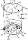 Fig. 01 - Ball retrieval apparatus and system
