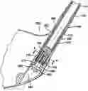 Fig. 01 - Golf club head