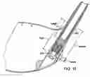 Fig. 09 - Golf club head