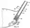 Fig. 10 - Golf club head