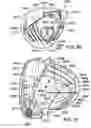 Fig. 45 - Golf club head