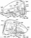 Fig. 46 - Golf club head