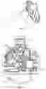 Fig. 05 - Sports throwing motion training device