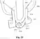 Fig. 10 - System and method for fluid processing
