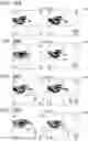 Fig. 20 - DEVICE AND METHOD FOR DETECTING NUCLEIC ACID