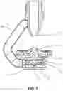 Fig. 02 - Eddy current sprinkler dampener