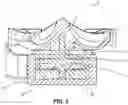Fig. 03 - Eddy current sprinkler dampener