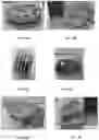 Fig. 11 - METHOD AND SYSTEM FOR ADDITIVE MANUFACTURING WITH POWDER MATERIAL