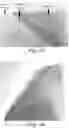 Fig. 05 - ABRASIVE SHEET INCLUDING A PLURALITY OF PROTRUSIONS