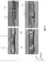 Fig. 07 - Multidirectional locomotive module with omnidirectional bending