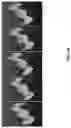 Fig. 15 - Multidirectional locomotive module with omnidirectional bending
