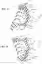 Fig. 09 - Razor structure