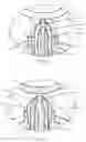 Fig. 03 - Movable Needle Valve of Hot-Runner Mold