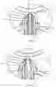 Fig. 08 - Movable Needle Valve of Hot-Runner Mold