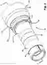 Fig. 03 - Axle and spindle for heavy-duty vehicle and method