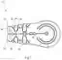 Fig. 06 - Throttle pedal assembly
