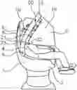 Fig. 01 - Inflatable restraint device for a vehicle