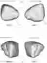 Fig. 07 - Airbag arrangement